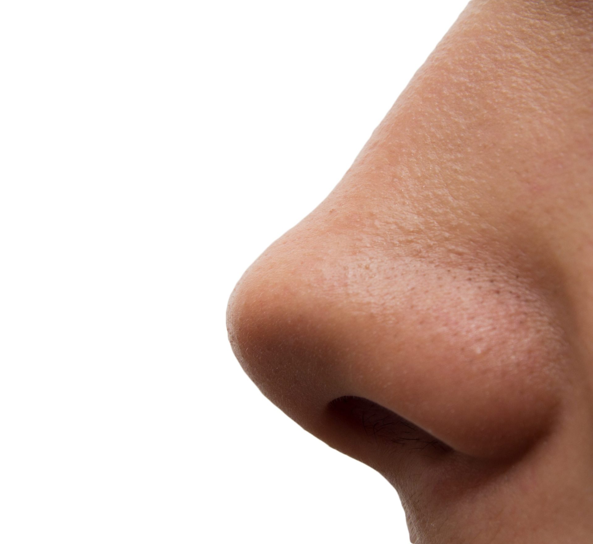 Tetraplégica americana desenvolve um nariz nas costas depois de um tratamento com células estaminais