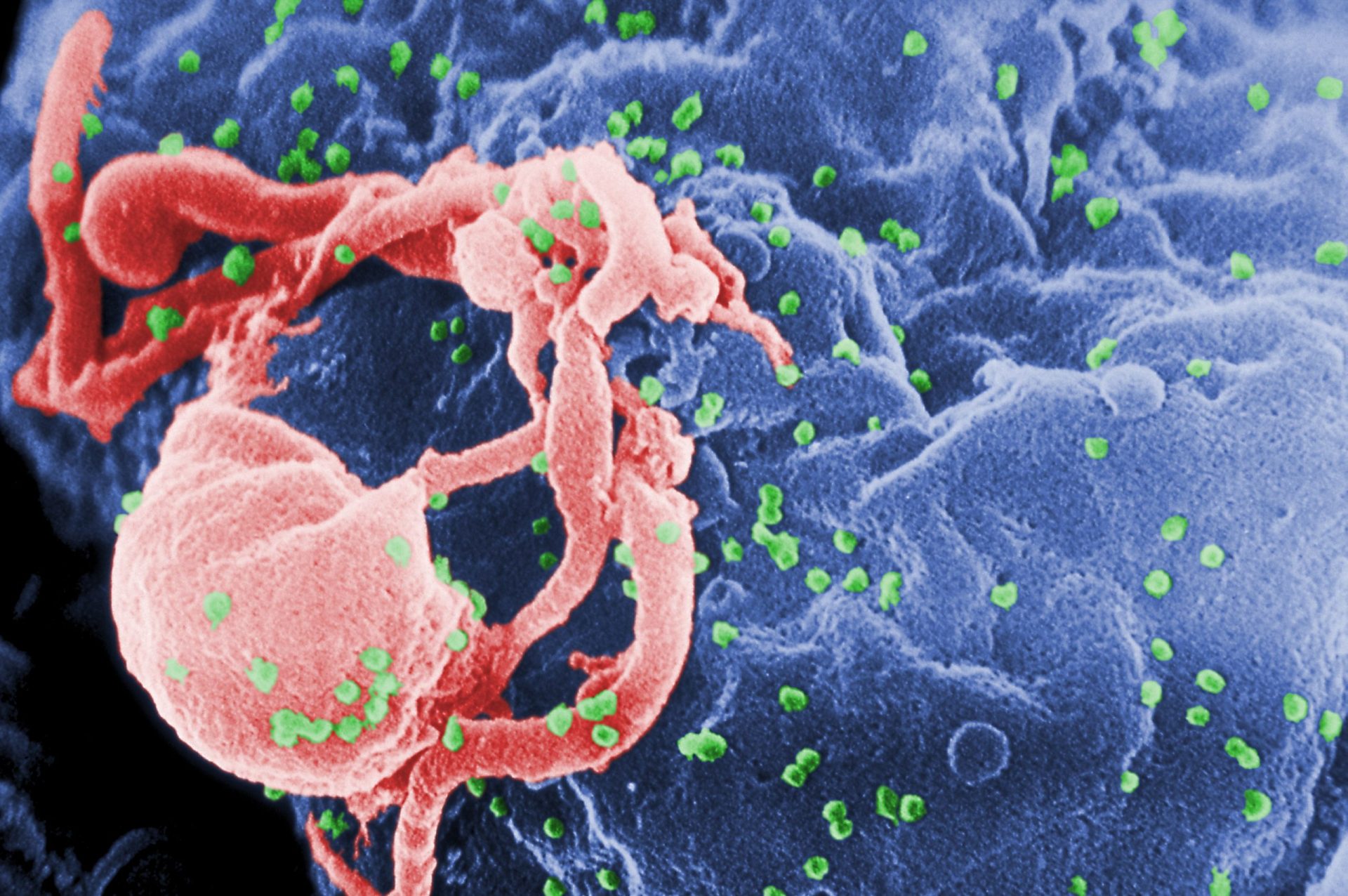 Número de infectados com VIH/SIDA diminuiu