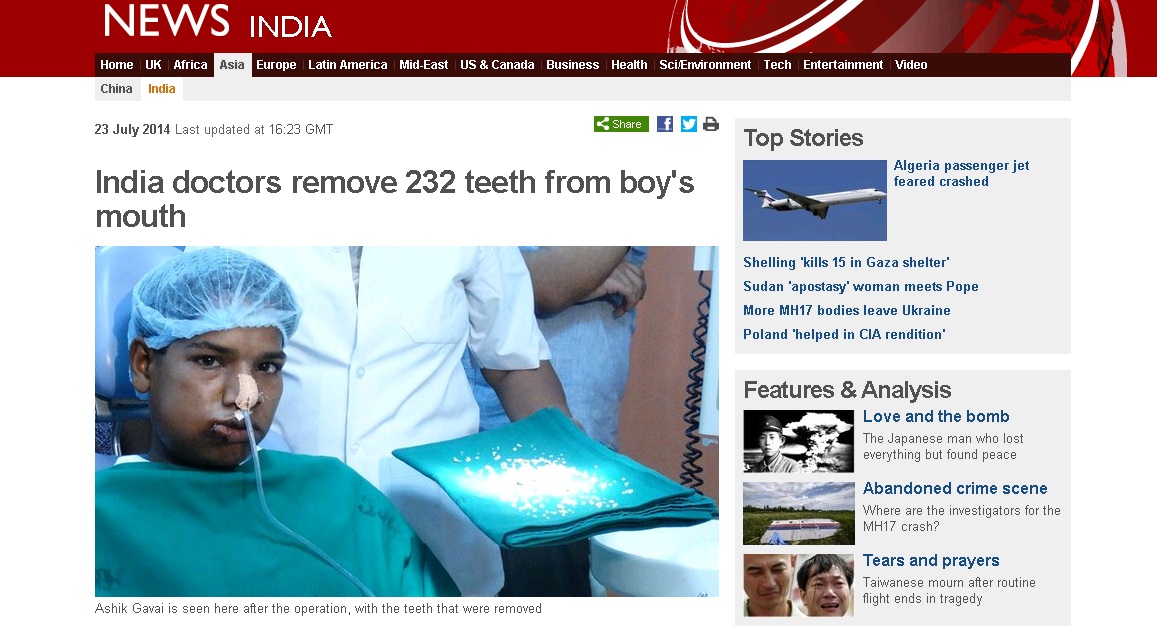 Médicos extraíram 232 dentes de um jovem