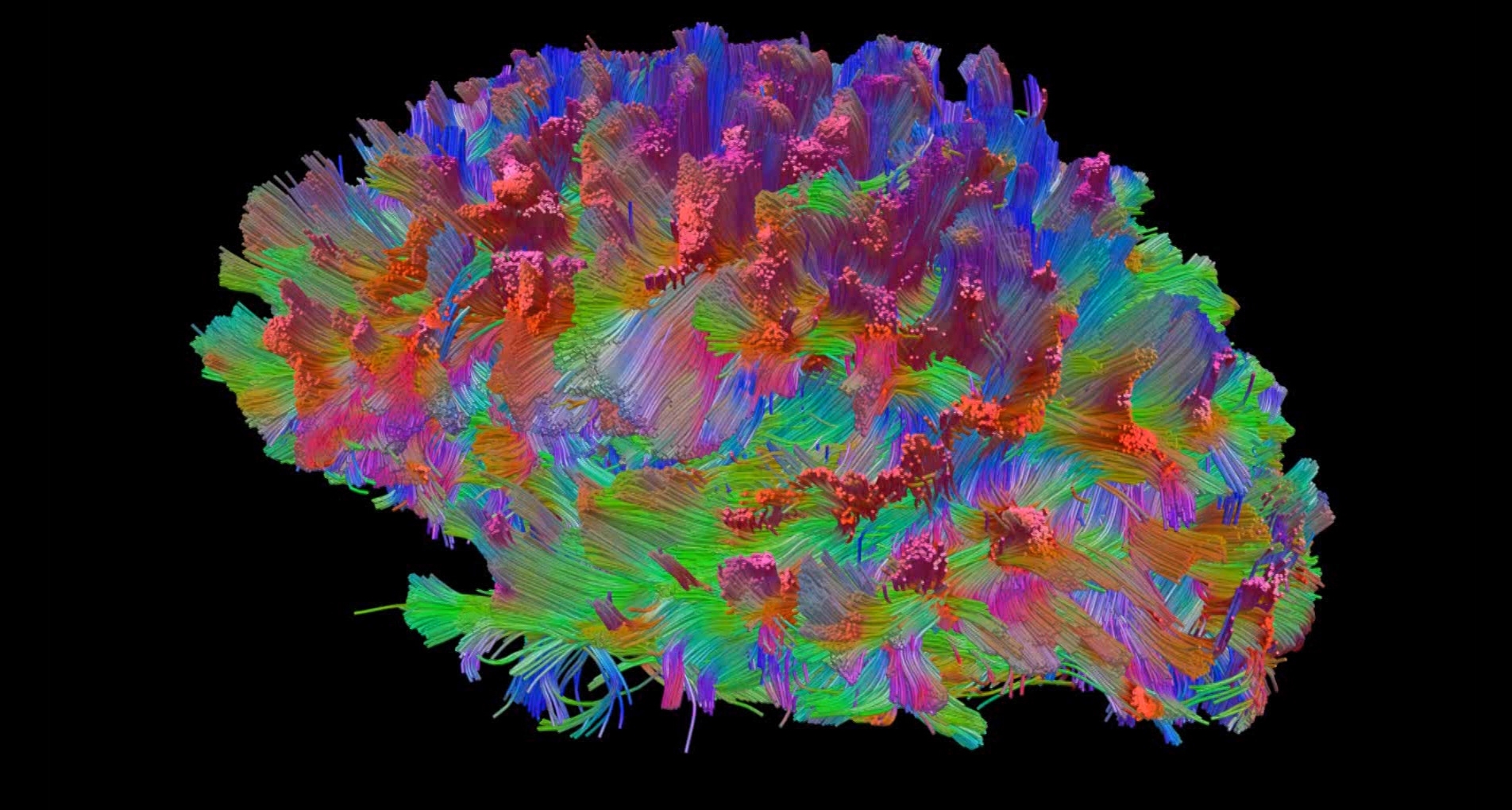 Universidade do Minho desenvolve modelo cerebral em fibra