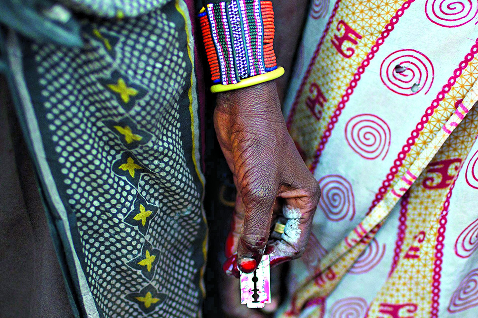 Hospitais registam 43 casos de mutilação genital feminina