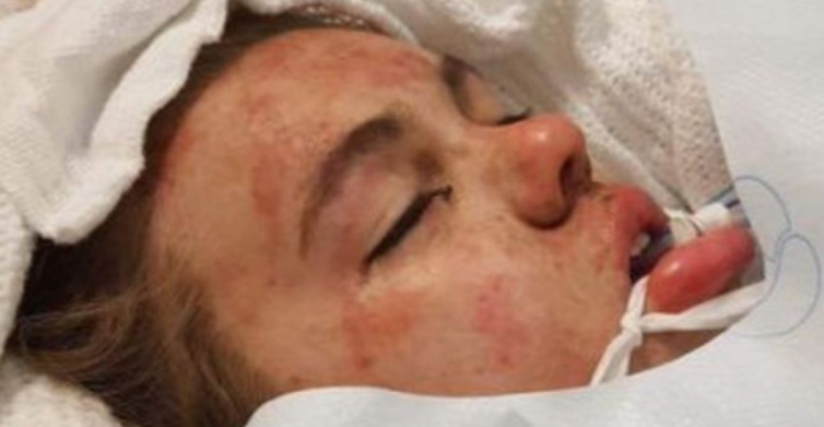 Mãe publica fotos da filha em coma para alertar jovens sobre os efeitos do ecstasy