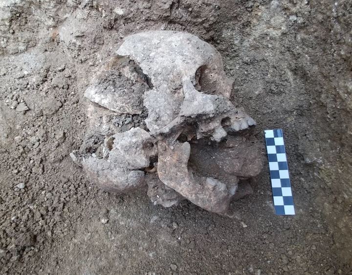 ‘Criança vampira’ foi enterrada há mais de 1500 anos em Itália