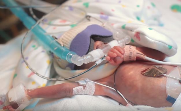 Ward nasceu com 5 meses de gestação e o pai decidiu gravar o seu primeiro ano de vida | Vídeo