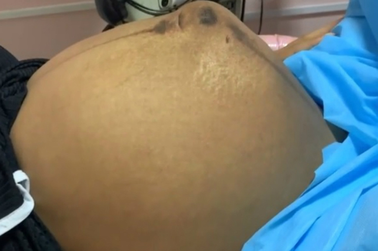 Bebé mexeu-se de forma impressionante na barriga da mãe | Vídeo