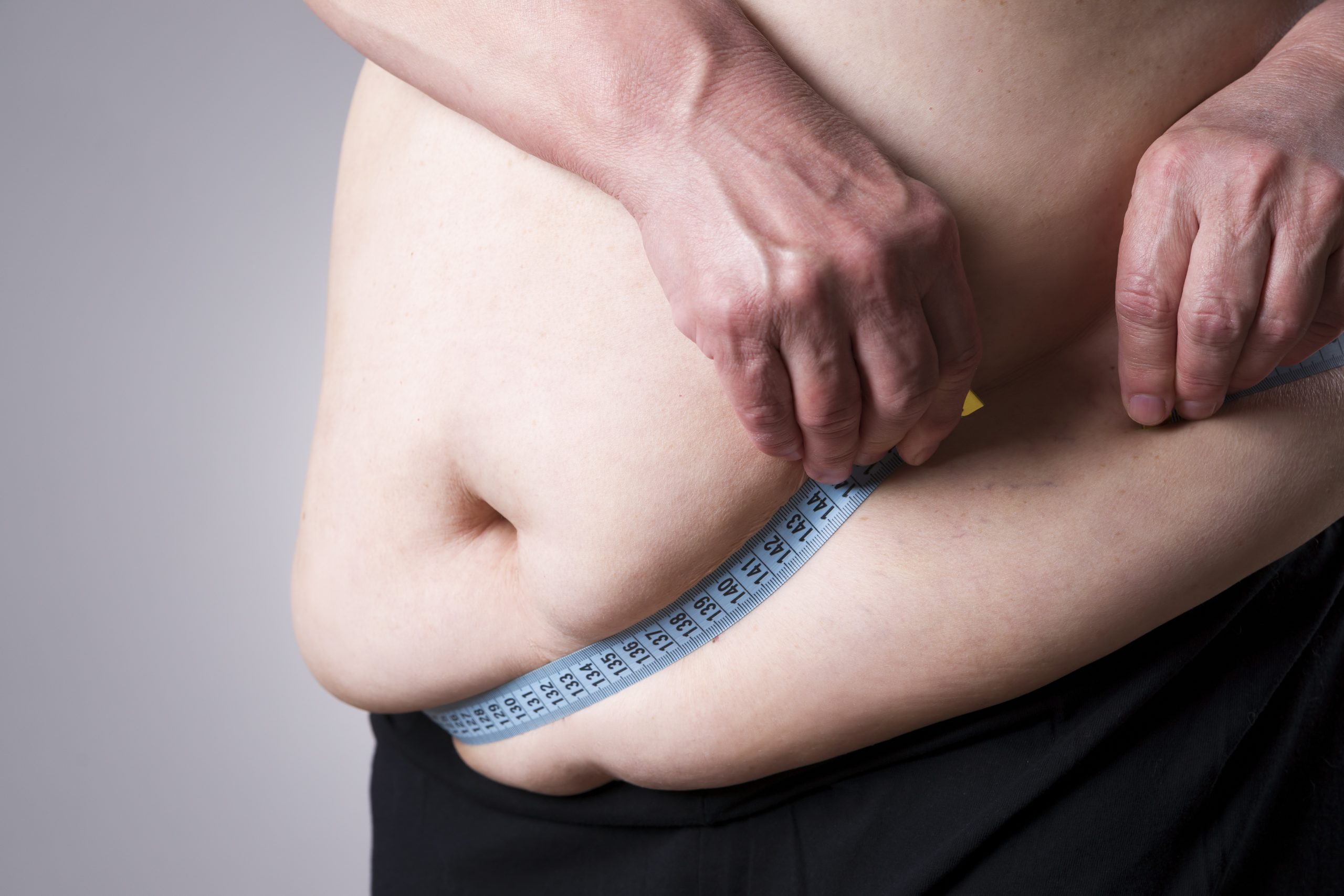Estudo diz que obesidade aumenta discriminação laboral