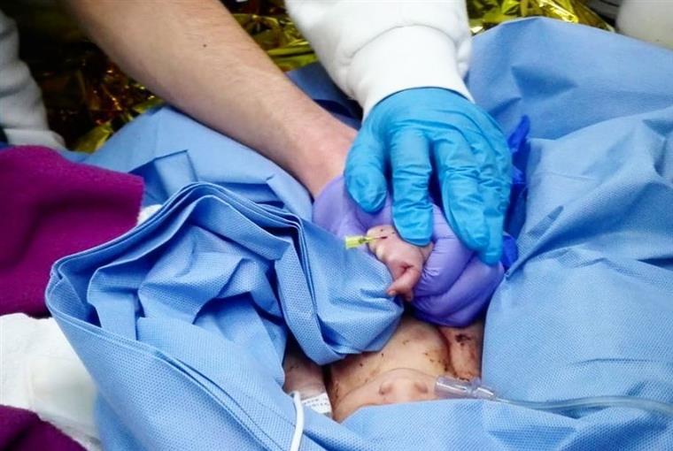 Bebé abandonado no lixo fica com família de acolhimento após ter alta hospitalar