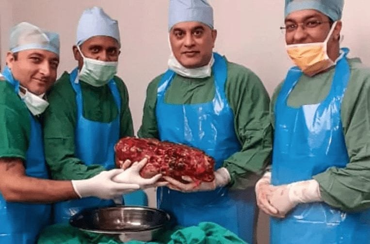 Médicos removem rim de paciente com mais de sete quilos