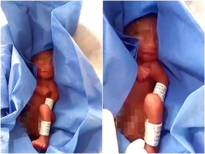 Bebé prematuro dado como morto foi encontrado com vida na morgue seis horas depois
