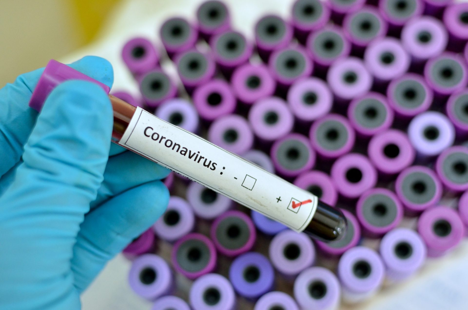 Só menos de 2% dos infetados com coronavírus já estão recuperados