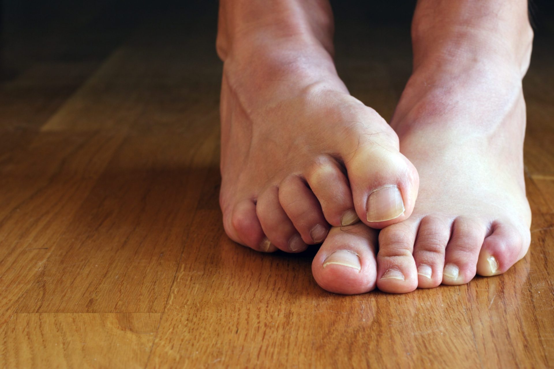 Porque é que os pés cheiram mal? [vídeo]