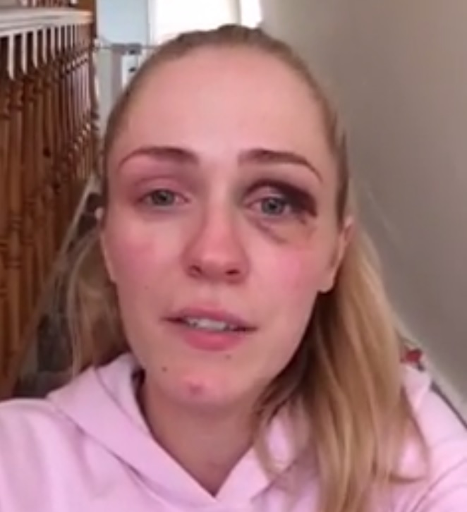 O testemunho viral de uma vítima de violência doméstica [vídeo]