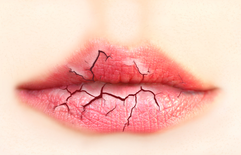 5 dicas para deixar de ter cieiro e os lábios secos