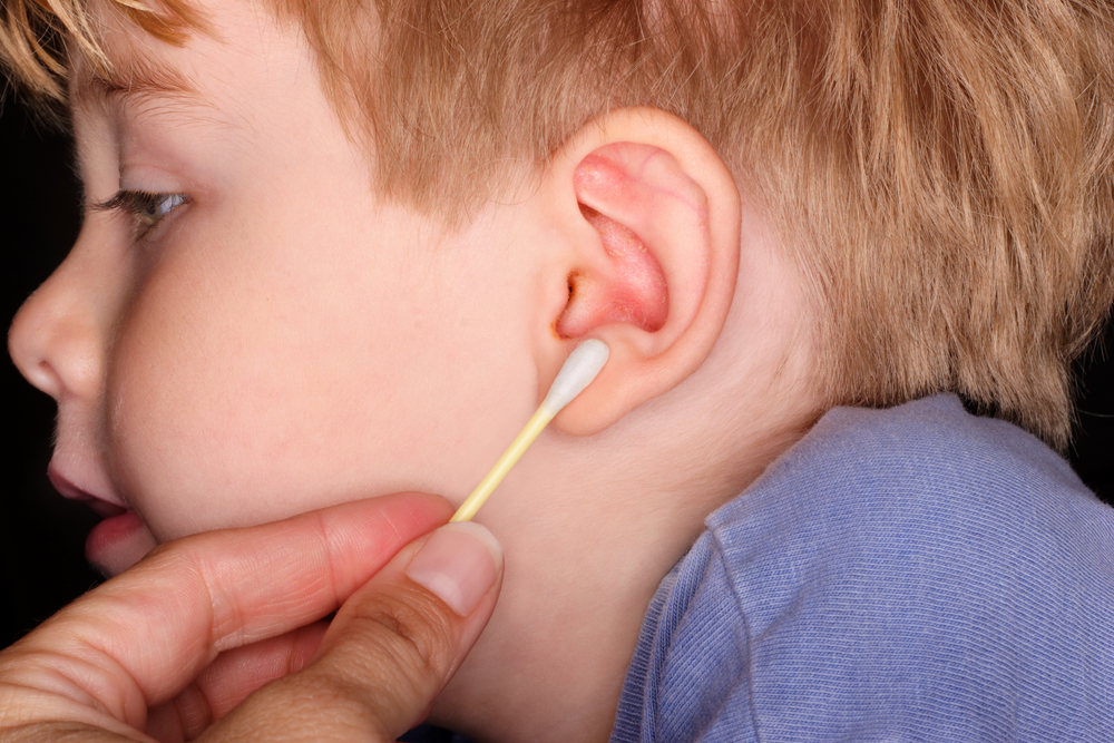 Porque é que nunca devemos utilizar cotonetes para limpar os ouvidos?