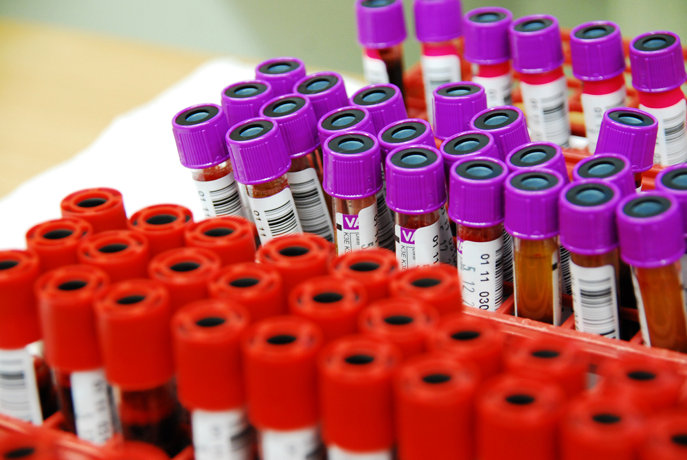Investigadores de Coimbra desenvolvem vacina mais barata para hepatite B