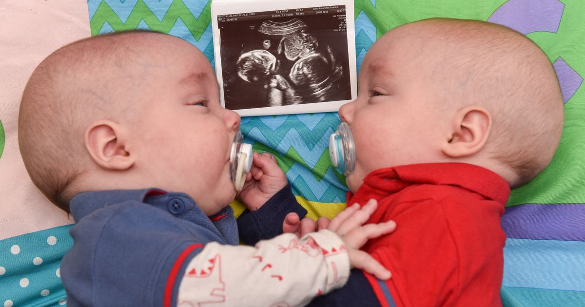Irmãos gémeos dão abraço dentro de útero e salvam vida um ao outro