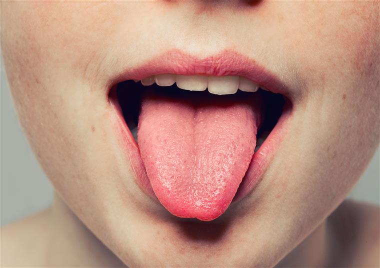 A língua pode dizer muito sobre a nossa saúde
