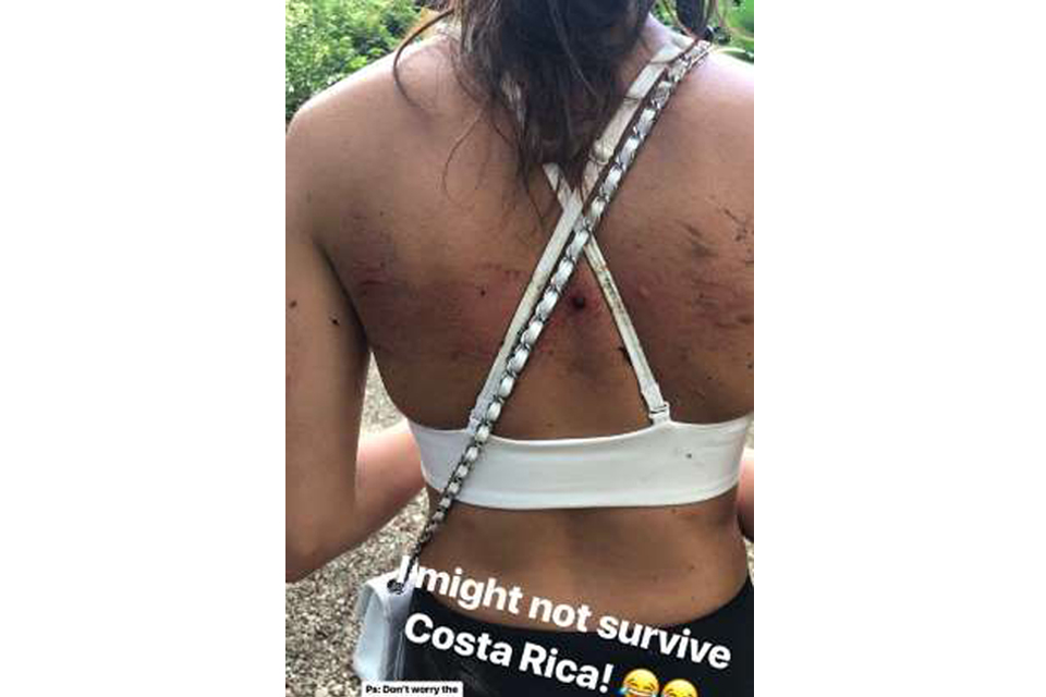 Sara Sampaio sofre acidente na Costa Rica