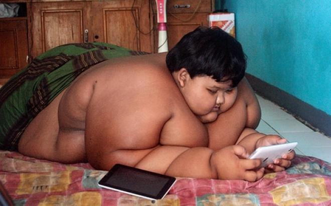 Lembra-se da criança mais gorda do mundo? Perdeu 95 quilos e está (quase) irreconhecível
