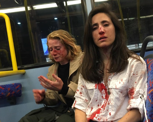 Casal de namoradas agredido em Londres depois de trocarem um beijo