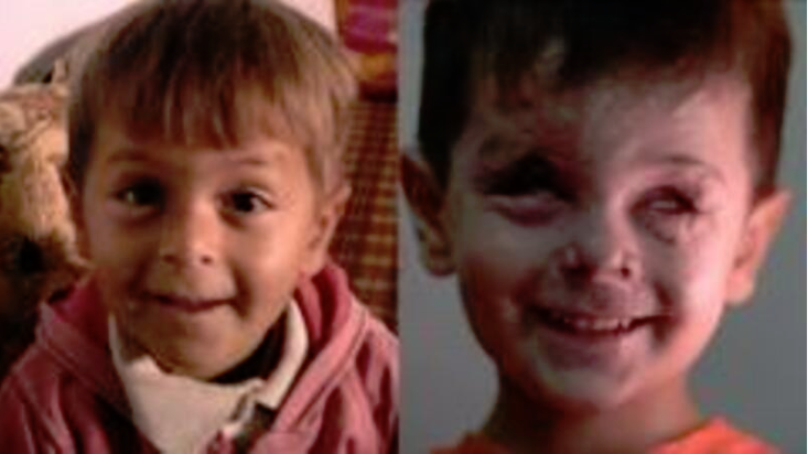 Jouma: a criança a quem a guerra na Síria tirou a visão