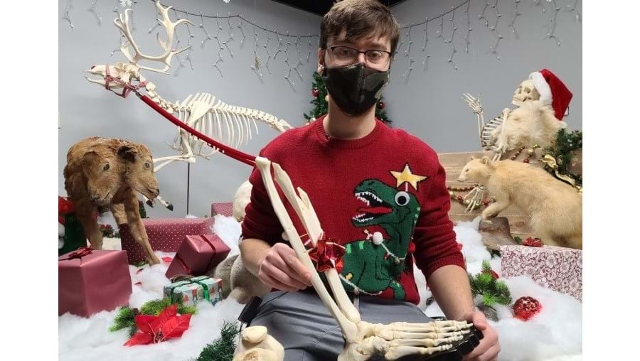 Jovem perde perna e recebe ossos reconstruídos como prenda de Natal
