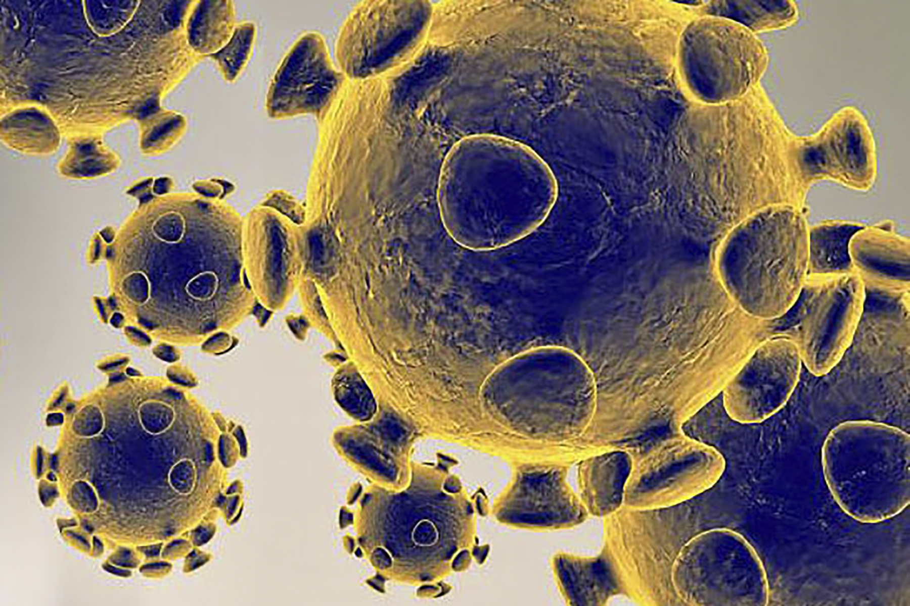 Há um segundo português infetado pelo novo coronavírus no estrangeiro
