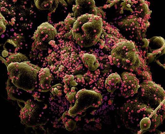 Imagens mostram como o novo coronavírus mata as células humanas