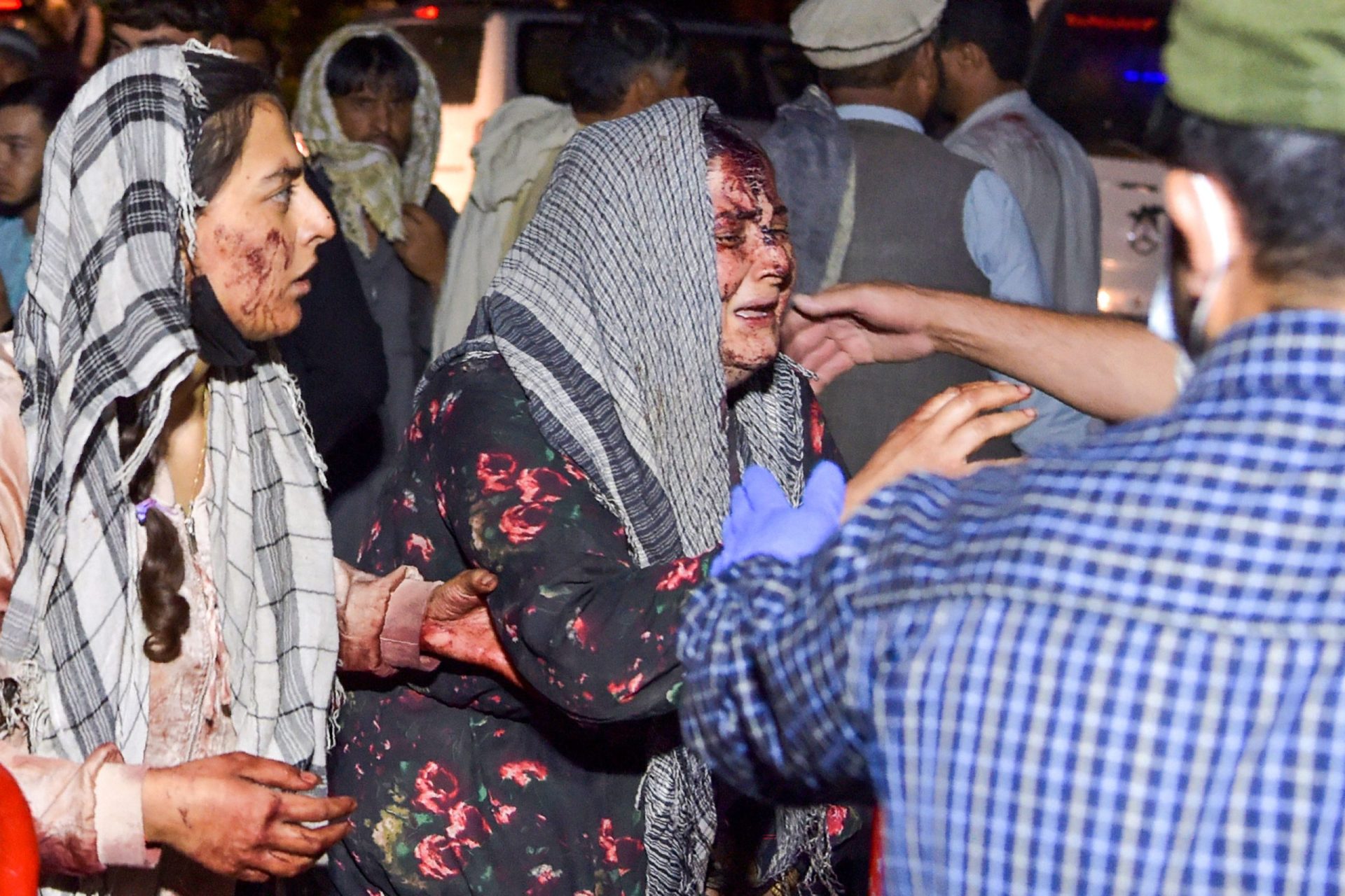 Pelo menos 60 mortos e mais de 140 feridos em Cabul. Estado Islâmico reivindica ataques