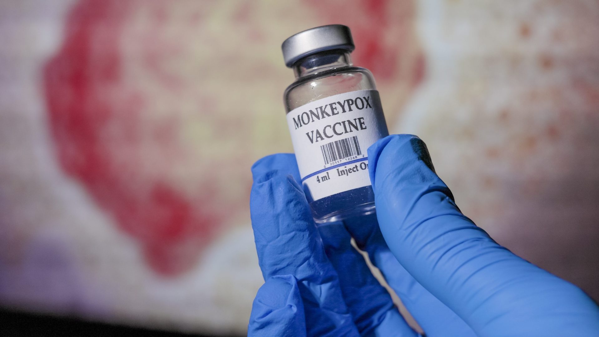 União Europeia vai comprar cerca de 110 mil vacina contra o Monkeypox