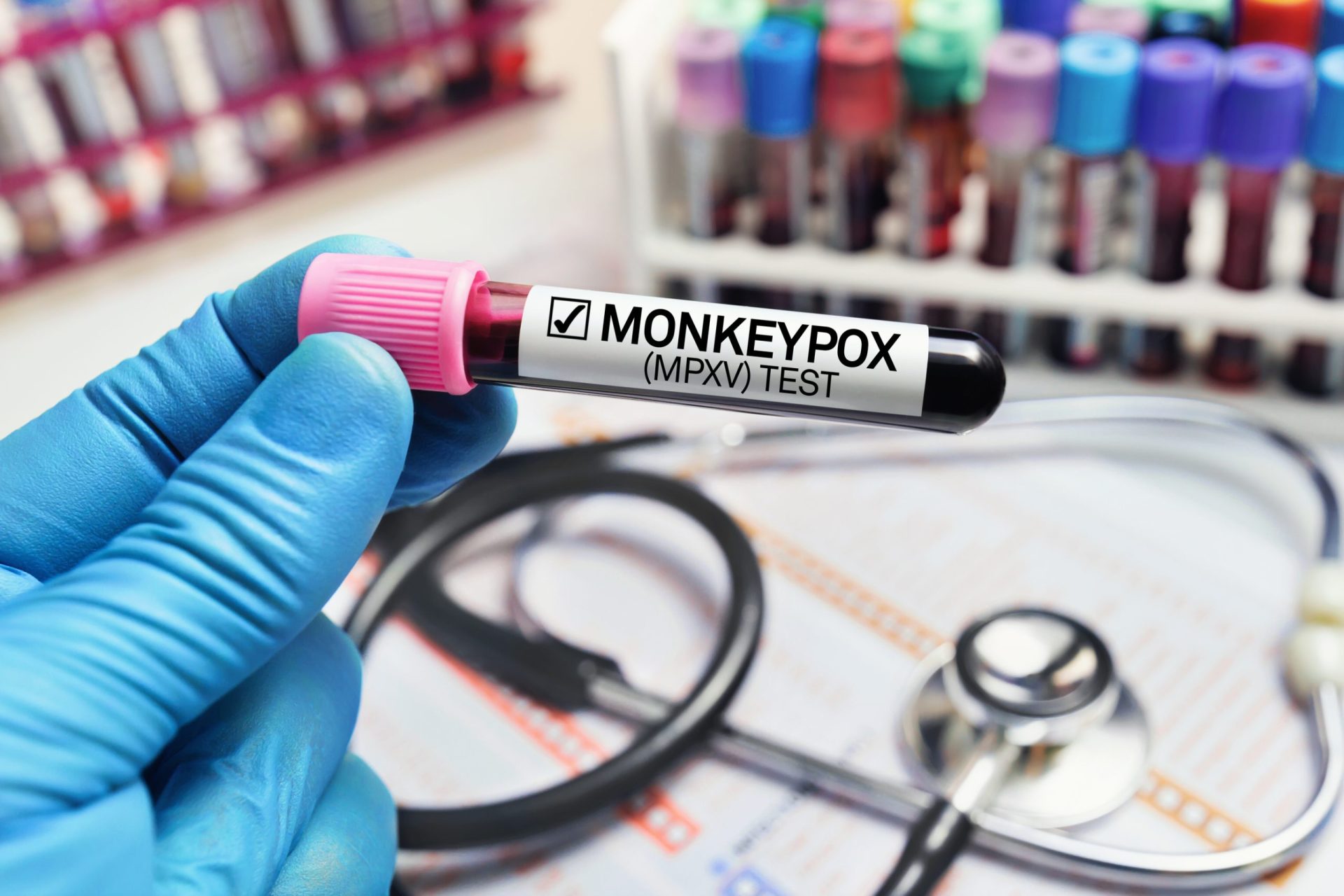 Portugal com 710 casos de monkeypox