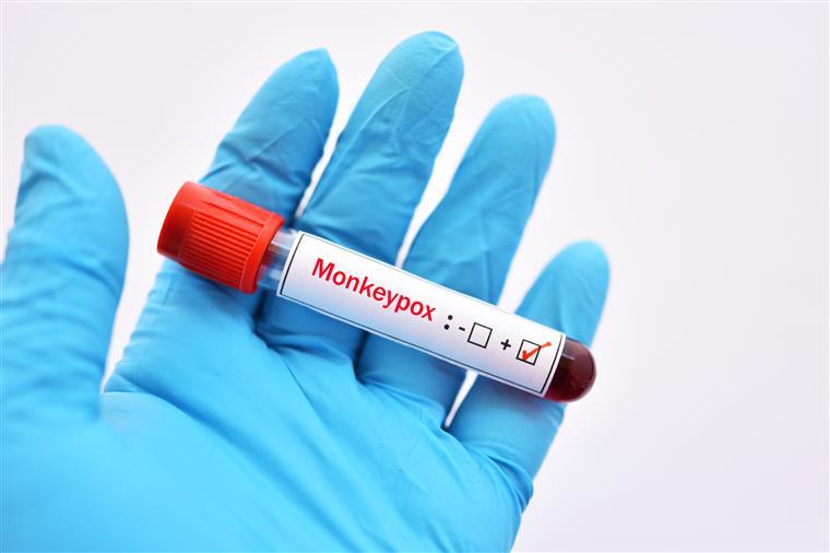 Reino Unido descobre nova estirpe de Monkeypox