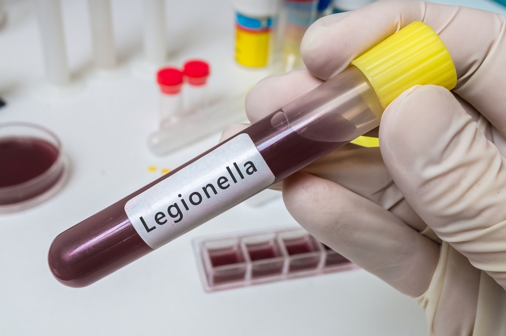 Legionella leva ao encerramento de hotel