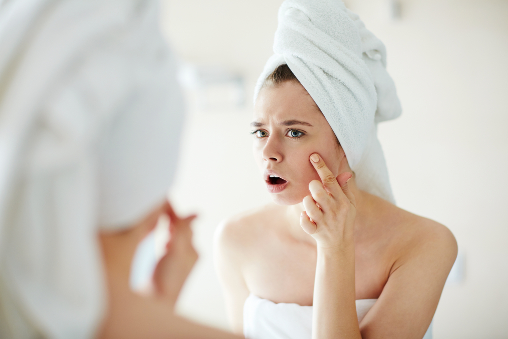 Oito coisas que podem estar a piorar o seu acne