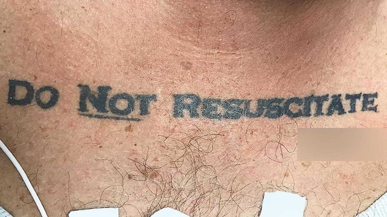 A tatuagem que deixou uma equipa de médicos sem saber o que fazer