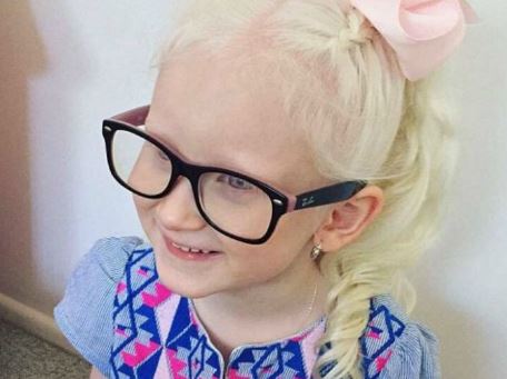 Frozen. Princesa Elsa muda vida de menina albina
