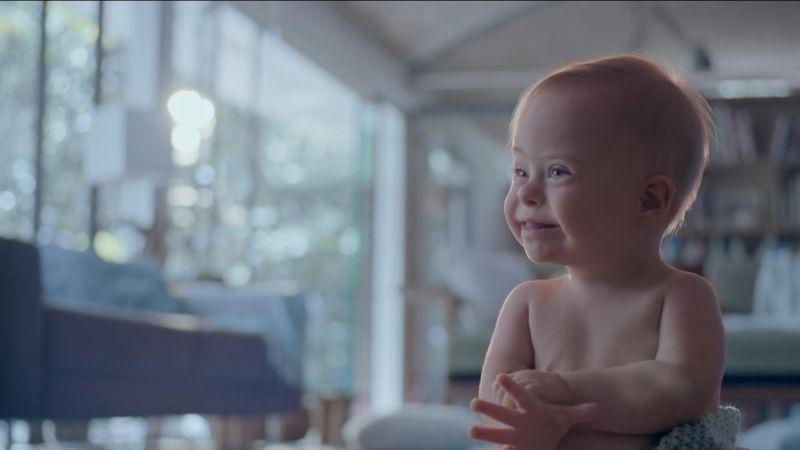 Bebé com síndrome de Down é protagonista de campanha publicitária [vídeo]