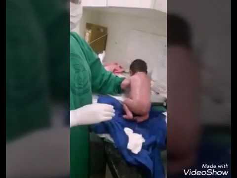 Bebé começa a andar minutos após ter nascido | VÍDEO