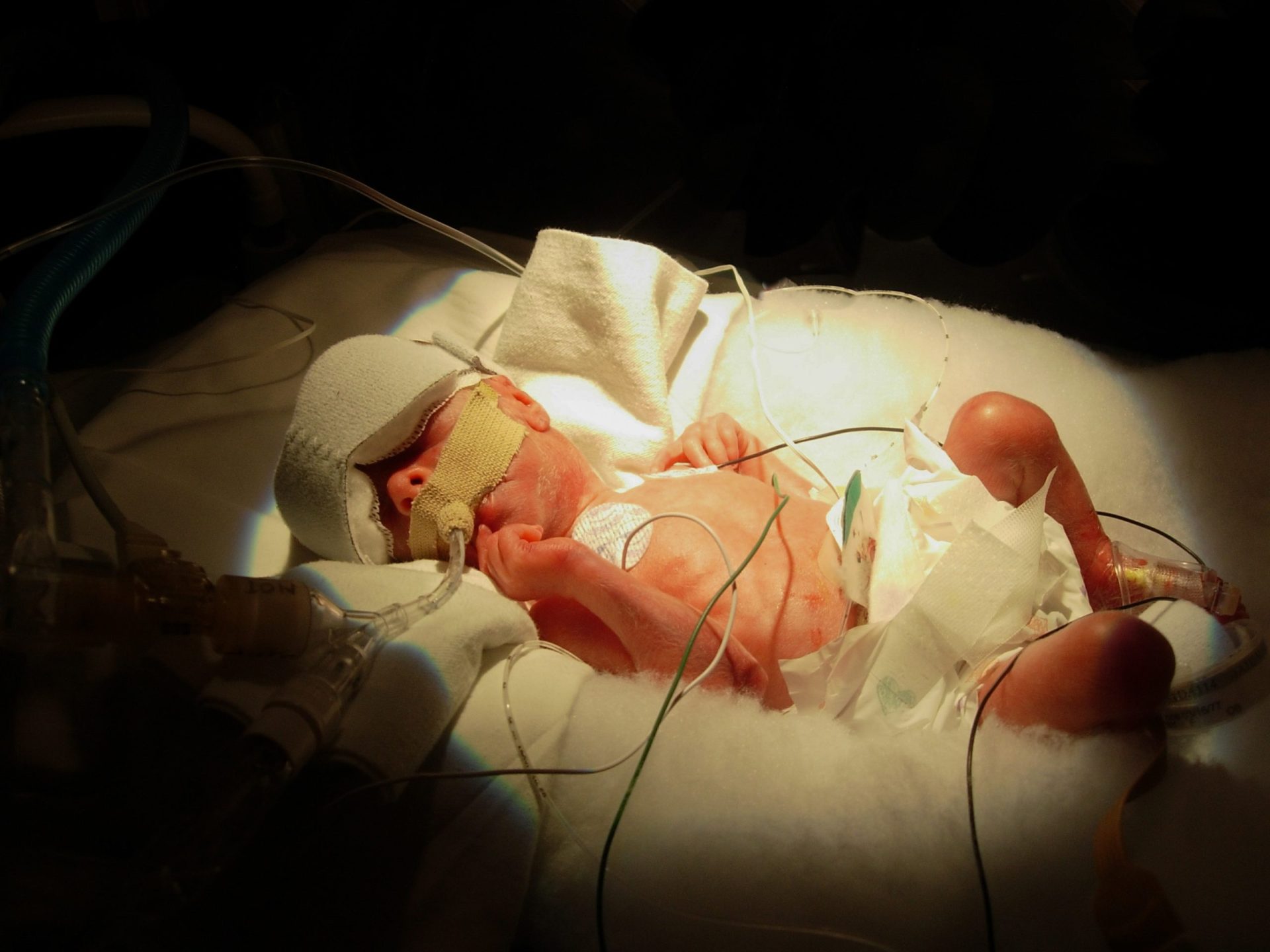 Rutura no Hospital de Faro. Bebés prematuros sem cuidados assegurados