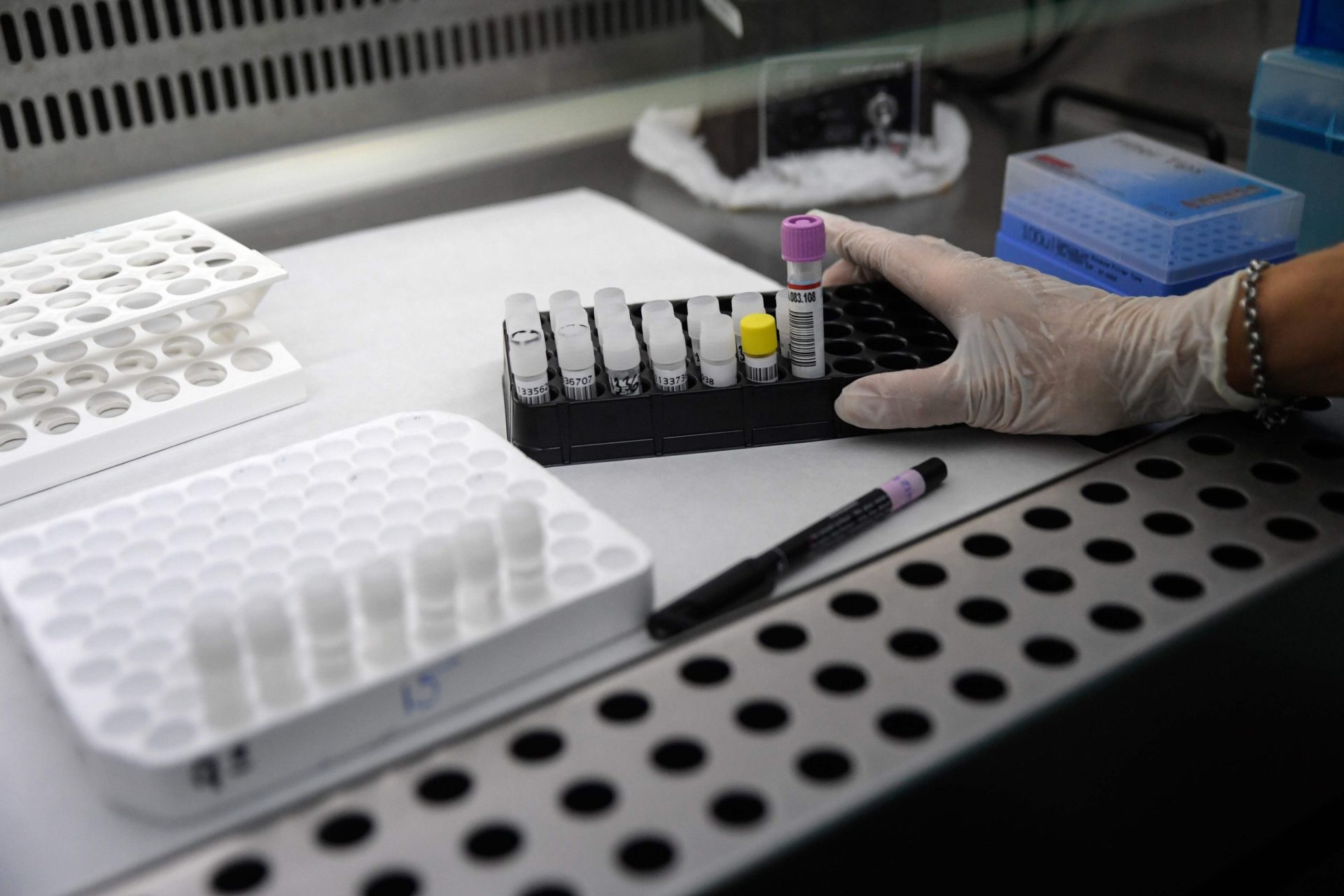 Laboratórios privados já estão a fazer testes de imunidade pedidos por médicos