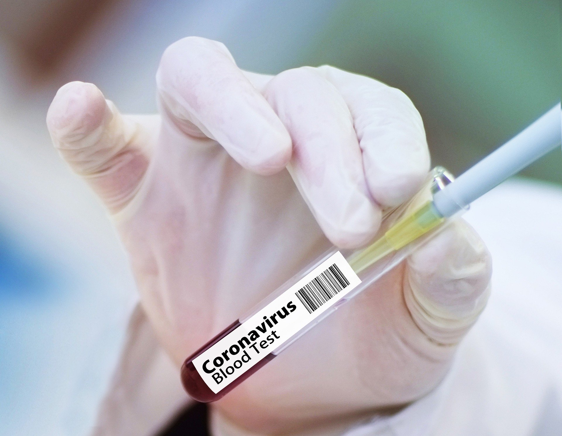 Oxford espera ter vacina contra a covid-19 disponível em dezembro