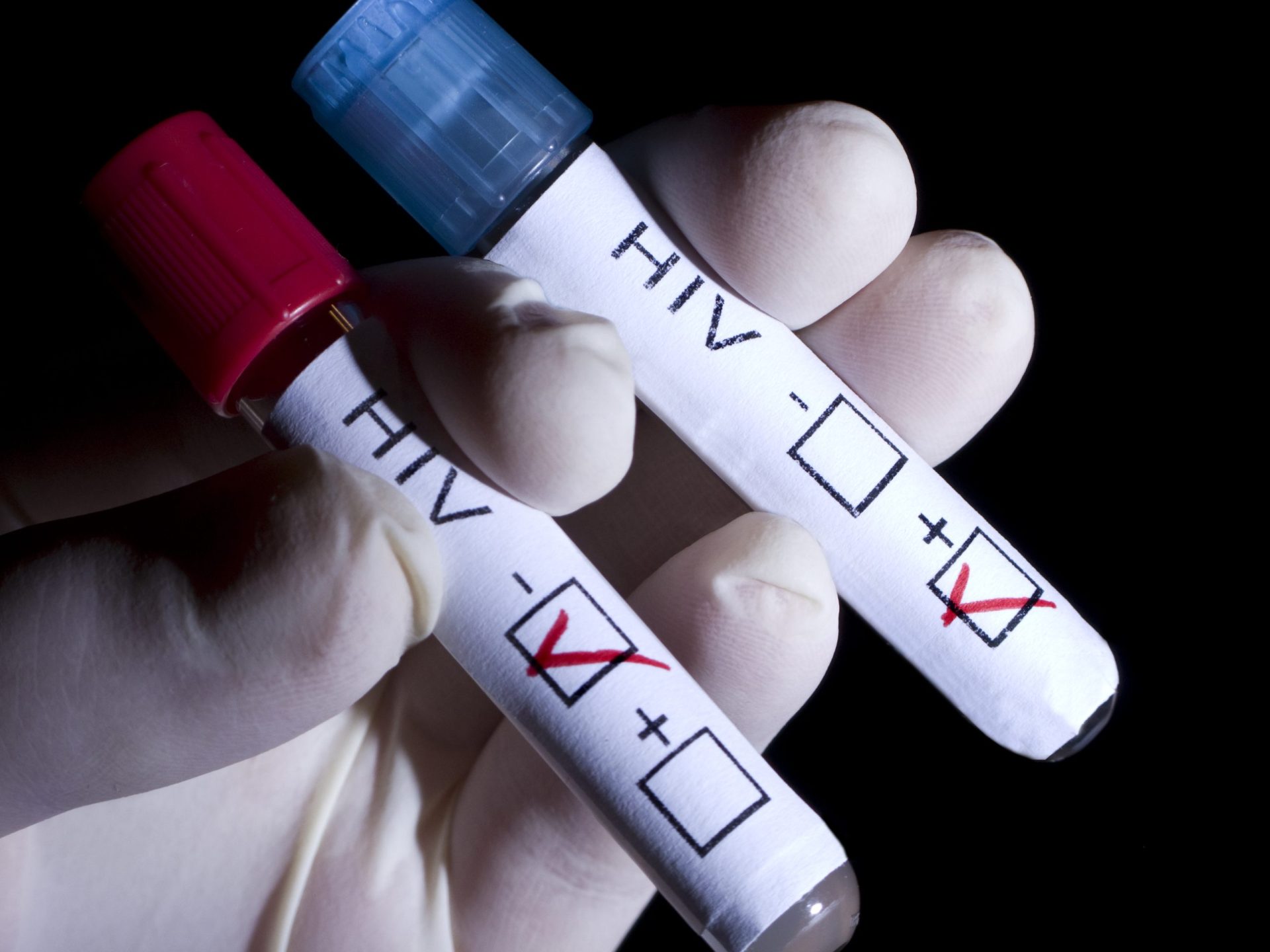 Como estava a epidemia de VIH antes da covid-19
