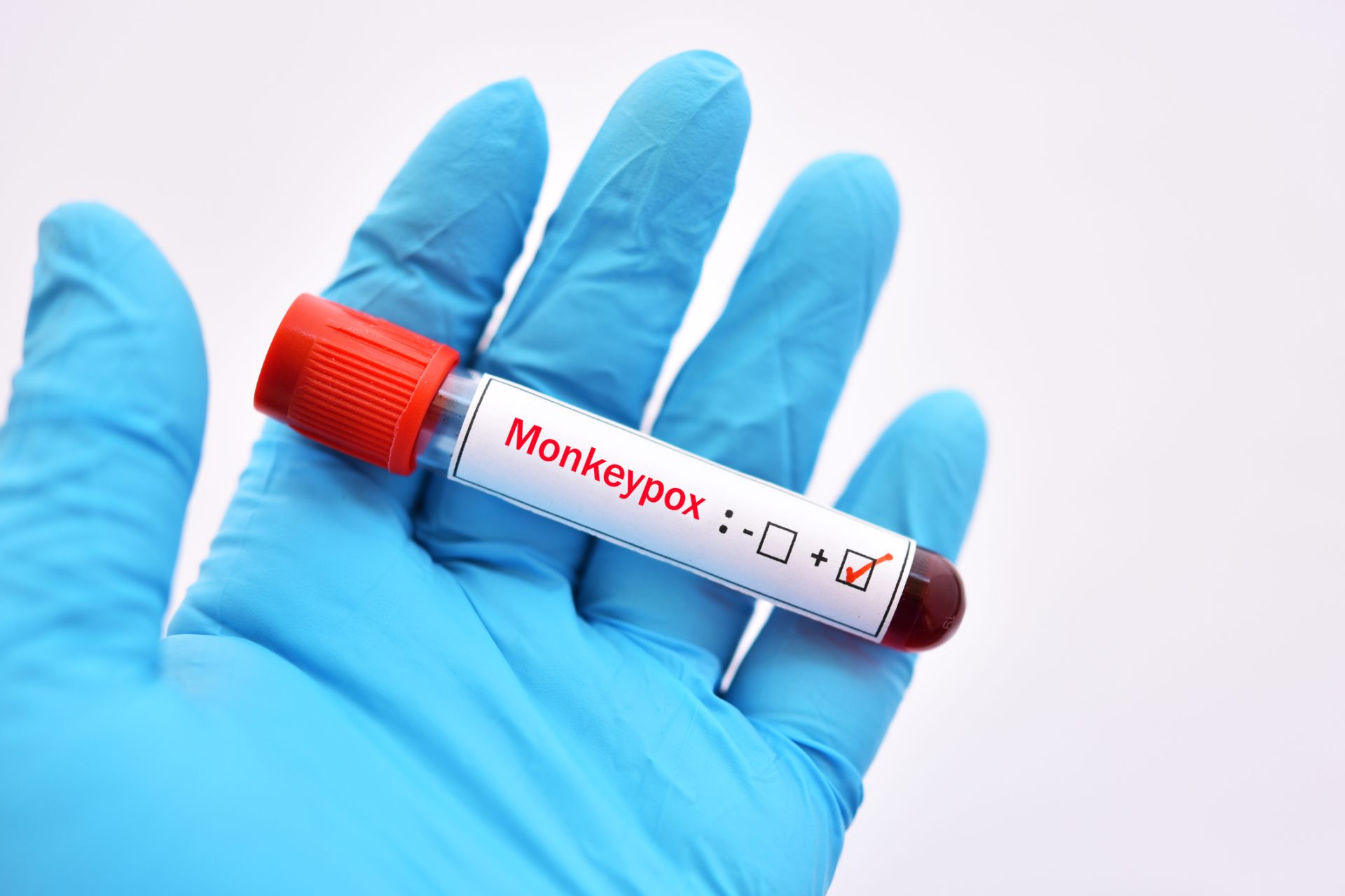 CDC diz que monkeypox “não é a covid-19” e não se transmite facilmente pelo ar