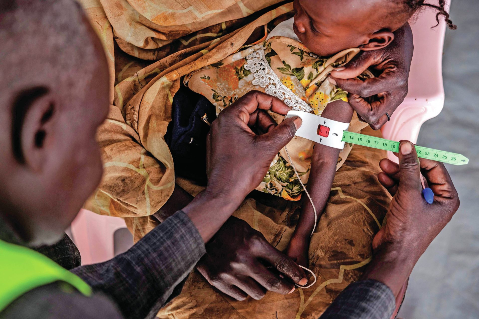 Aumento da subnutrição e maior crise de deslocados do mundo